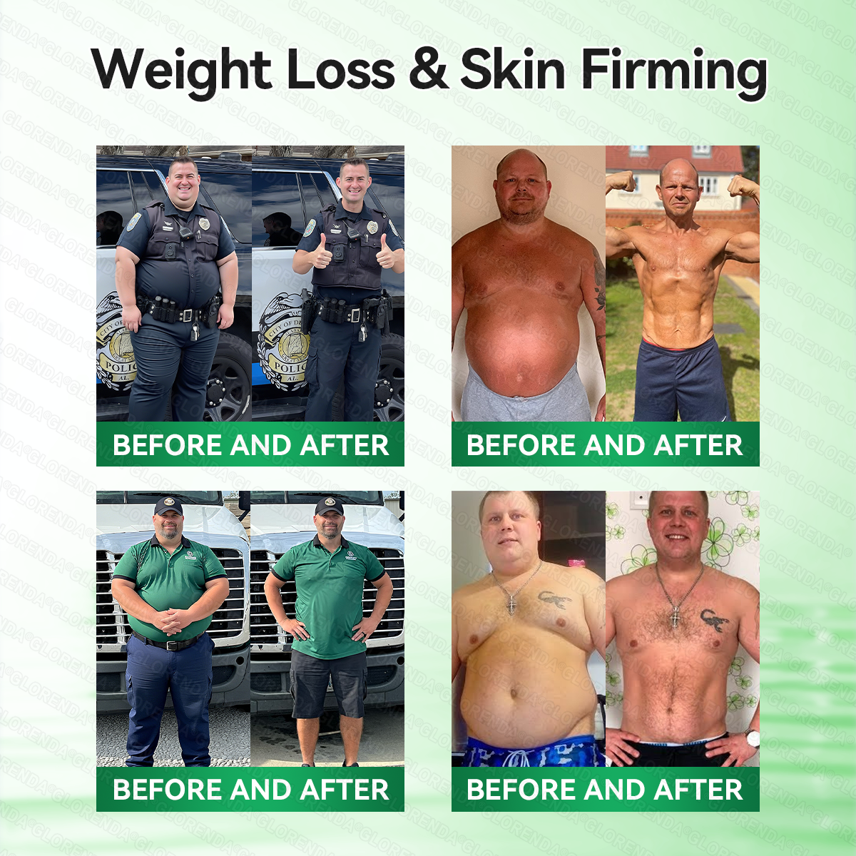 𝗖𝗔 𝑶𝒇𝒇𝒊𝒄𝒊𝒂𝒍 𝑺𝒕𝒐𝒓𝒆  |🍁🍁𝐂𝐚𝐫𝐞𝐔𝐩𝐥𝐢𝐟𝐭® 𝙈𝒐𝒓𝒊𝒏𝒈𝗮 · 𝗕𝗲𝗿𝗯𝐞𝐫𝐢𝐧𝙚 × 𝙉𝑨𝑫+ 𝟏𝟎-𝙞𝙣-𝟏 𝘼𝒅𝒗𝒂𝒏𝒄𝒆𝐝 𝐍𝐚𝐧𝙤 𝙈𝙞𝙘𝙧𝙤𝙣𝒆𝒆𝒅𝒍𝐞 𝐏𝐚𝐭𝙘𝙝(𝐉𝐮𝐬𝐭 𝐨𝐧𝐜𝐞 𝐚 𝐝𝐚𝐲,𝐯𝐢𝐬𝐢𝐛𝐥𝐞 𝐜𝐡𝐚𝐧𝐠𝐞𝐬 𝐢𝐧 𝟕 𝐝𝐚𝐲𝐬）✅𝐅𝐨𝐫 𝐨𝐛𝐞𝐬𝐢𝐭𝐲,🅛🅞🅞🅢🅔 🅢🅚🅘🅝,𝐝𝐢𝐚𝐛𝐞𝐭𝐞𝐬,𝐬𝐥𝐞𝐞𝐩 𝐚𝐩𝐧𝐞𝐚,𝐣𝐨𝐢𝐧𝐭 𝐢𝐬𝐬𝐮𝐞𝐬,𝐚𝐧𝐝 𝐦𝐨𝐫𝐞