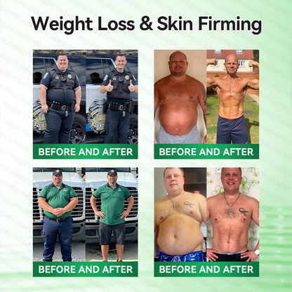 𝗖𝗔 𝑶𝒇𝒇𝒊𝒄𝒊𝒂𝒍 𝑺𝒕𝒐𝒓𝒆  |🍁🍁𝐂𝐚𝐫𝐞𝐔𝐩𝐥𝐢𝐟𝐭® 𝙈𝒐𝒓𝒊𝒏𝒈𝗮 · 𝗕𝗲𝗿𝗯𝐞𝐫𝐢𝐧𝙚 × 𝙉𝑨𝑫+ 𝟏𝟎-𝙞𝙣-𝟏 𝘼𝒅𝒗𝒂𝒏𝒄𝒆𝐝 𝐍𝐚𝐧𝙤 𝙈𝙞𝙘𝙧𝙤𝙣𝒆𝒆𝒅𝒍𝐞 𝐏𝐚𝐭𝙘𝙝(𝐉𝐮𝐬𝐭 𝐨𝐧𝐜𝐞 𝐚 𝐝𝐚𝐲,𝐯𝐢𝐬𝐢𝐛𝐥𝐞 𝐜𝐡𝐚𝐧𝐠𝐞𝐬 𝐢𝐧 𝟕 𝐝𝐚𝐲𝐬）✅𝐅𝐨𝐫 𝐨𝐛𝐞𝐬𝐢𝐭𝐲,🅛🅞🅞🅢🅔 🅢🅚🅘🅝,𝐝𝐢𝐚𝐛𝐞𝐭𝐞𝐬,𝐬𝐥𝐞𝐞𝐩 𝐚𝐩𝐧𝐞𝐚,𝐣𝐨𝐢𝐧𝐭 𝐢𝐬𝐬𝐮𝐞𝐬,𝐚𝐧𝐝 𝐦𝐨𝐫𝐞