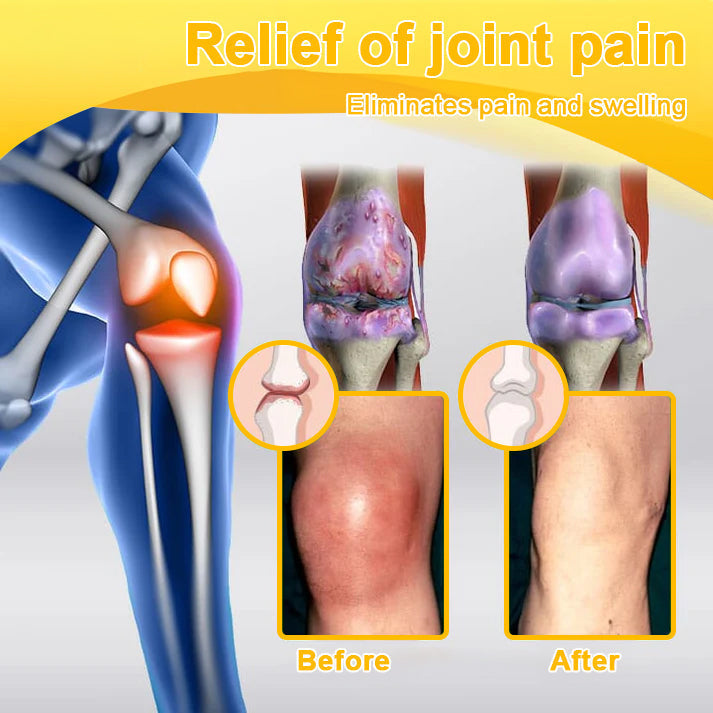 ADNOON® Botulinum Toxin & Bee Venom Pain-Relief Bone Healing Cream